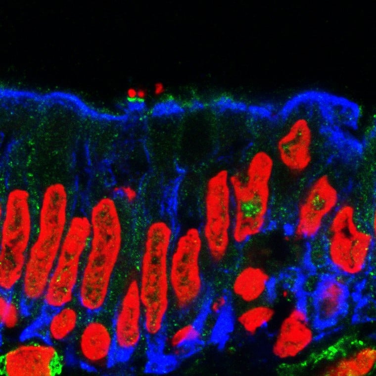 Pathogenic E. coli on the intestinal lining - S. Schuller