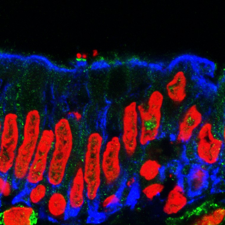 Pathogenic E. coli on the intestinal lining - S. Schuller